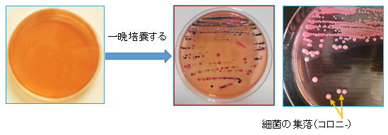 培養 同定 検査 細菌 嫌気性培養加算・細菌培養同定検査